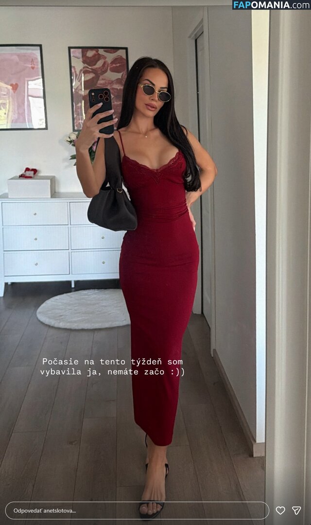 Anet Slotova / anetslotova Naken OnlyFans  Läckta Foto #1